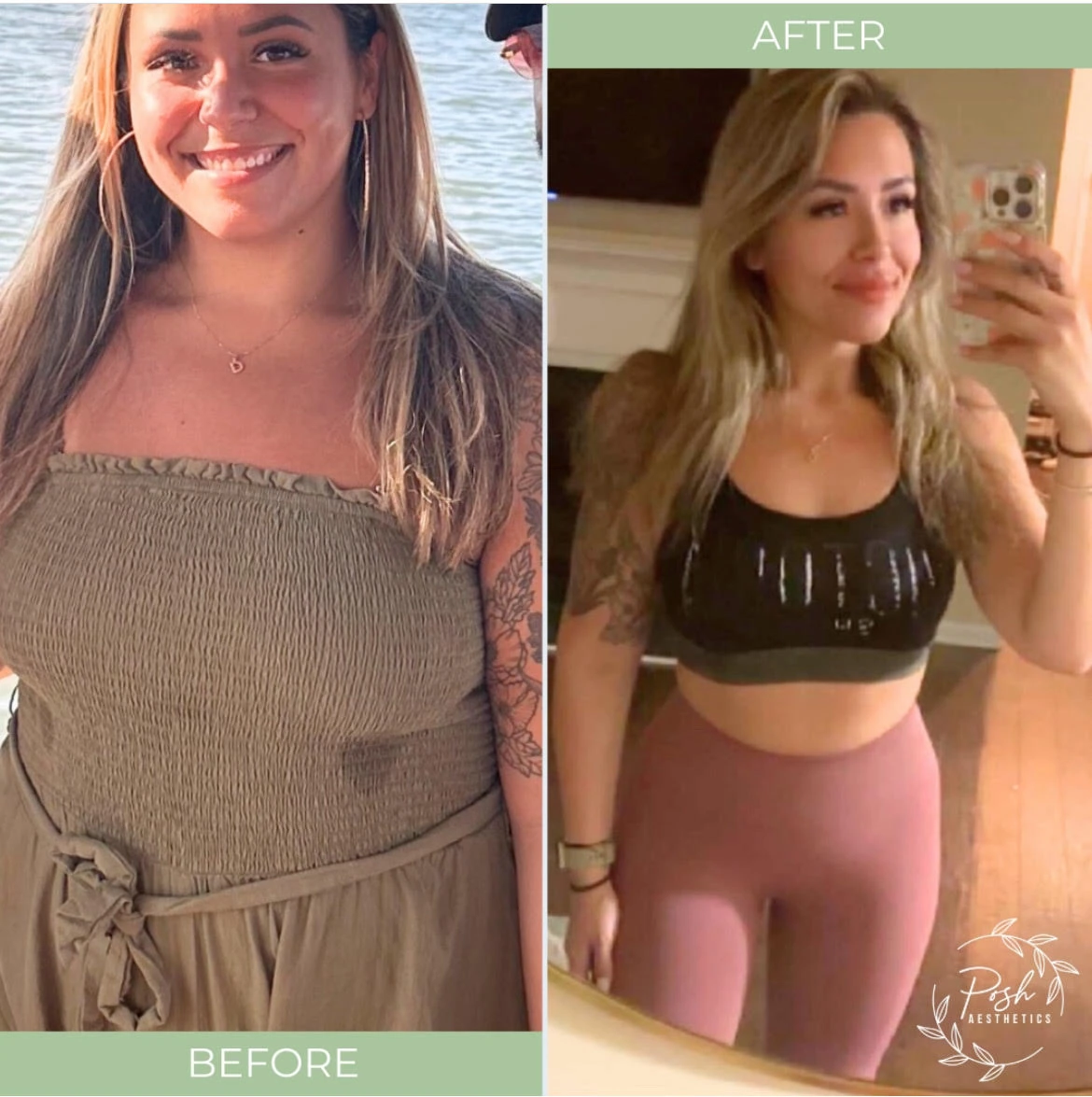 Weightloss Treatment Before After1 in Murrells Inlet, SC | Posh Aesthetics